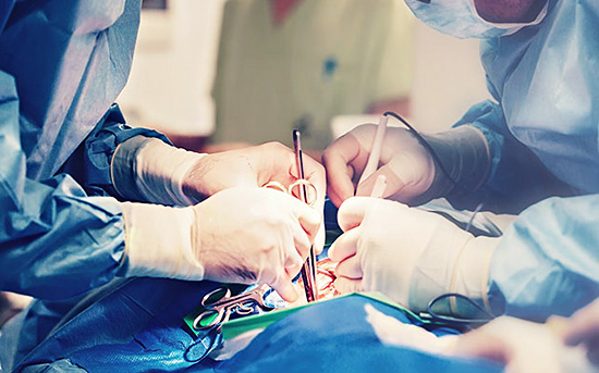Reconstructive Microsurgery